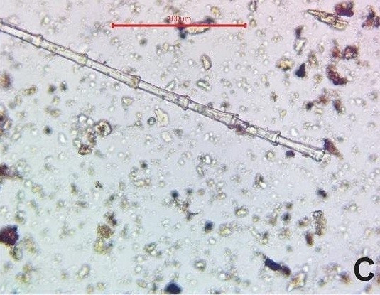 Các nhà nghiên cứu đã phân tích tổng cộng 139 mẫu đất lấy từ các ngôi mộ ở Skateholm. Đầu tiên, họ xác định các mảnh xương, đá lửa, than củi và hạt giống trong đất. Sau đó, họ sàng lọc và ly tâm các mẫu rồi quan sát các vi hạt còn lại bao gồm sợi, tóc và lông vũ dưới kính hiển vi. Ảnh: T. Kirkinen Kirkinen et al., Archaeological and Anthropological Sciences (2026).