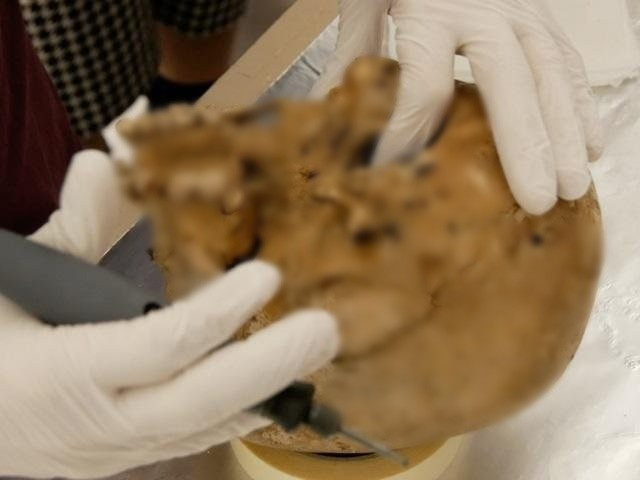 Các nhà nghiên cứu đặt biệt danh cho thiếu nữ trên là "Romito 2," theo tên hang động nơi hài cốt của cô và tám người săn bắn hái lượm thời tiền sử khác được tìm thấy vào năm 1963. Họ cho biết cô gái đã mắc một chứng rối loạn di truyền hiếm gặp gọi là chứng loạn sản chi giữa, thể Maroteaux (AMDM). Tình trạng này dẫn đến sự rút ngắn nghiêm trọng các chi, đặc biệt là cẳng tay, cẳng chân, bàn tay và bàn chân. Ảnh: Adrian Daly.