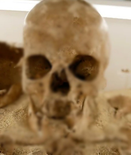 Cụ thể, kết quả kiểm tra bộ hài cốt của một thiếu nữ cho thấy người này mắc một dạng bệnh lùn hiếm gặp. Các nhà nghiên cứu cho biết đây là chẩn đoán ADN sớm nhất về một bệnh di truyền ở người hiện đại về mặt giải phẫu. Ảnh: Adrian Daly.