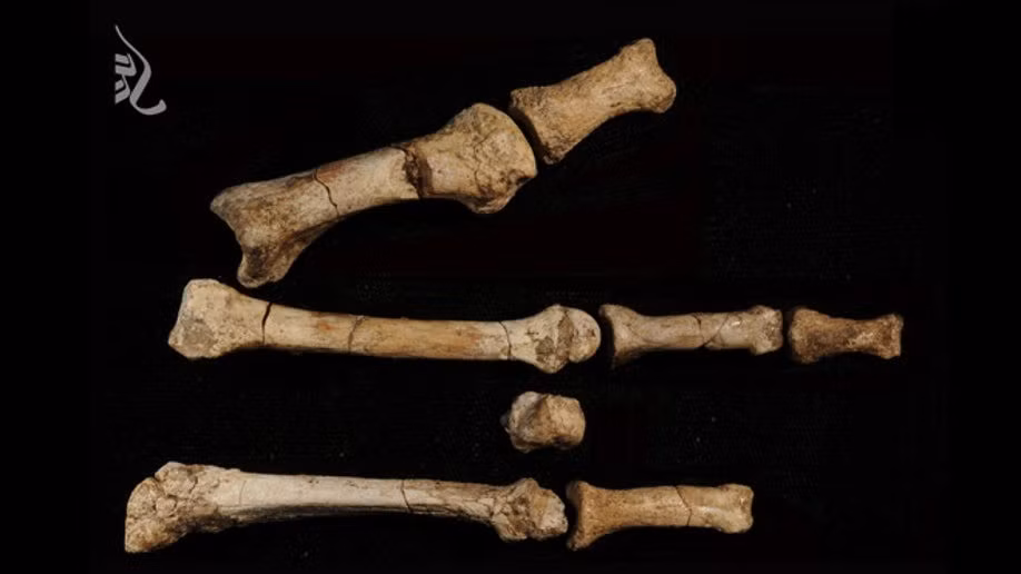 Điểm đặc biệt của "Burtele Foot" là ngón chân cái bị vẹo để thích ứng hoạt động leo trèo, nhưng chủ nhân vẫn có thể di chuyển bằng hai chân nhưng cách đi khác hẳn so với con người hiện đại. Ảnh: Yohannes Haile-Selassie / The Cleveland Museum of Natural History.