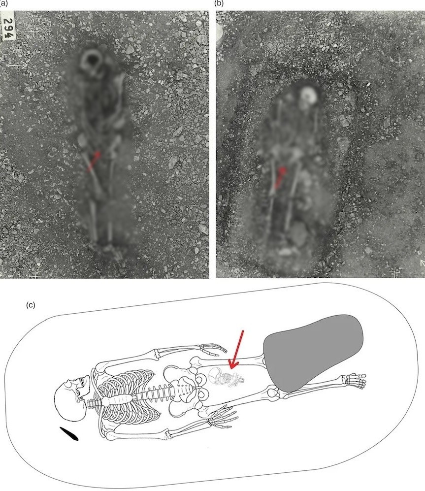 Những mảnh hài cốt của nữ chủ nhân mộ cổ cho thấy bà là một người trưởng thành trẻ tuổi hoặc trung niên. Hiện các chuyên gia không rõ liệu bà có phải tử vong khi đang mang thai hay mất lúc sinh con. Ảnh: Kopparsvik / Toplak / Matt Hitchcock.