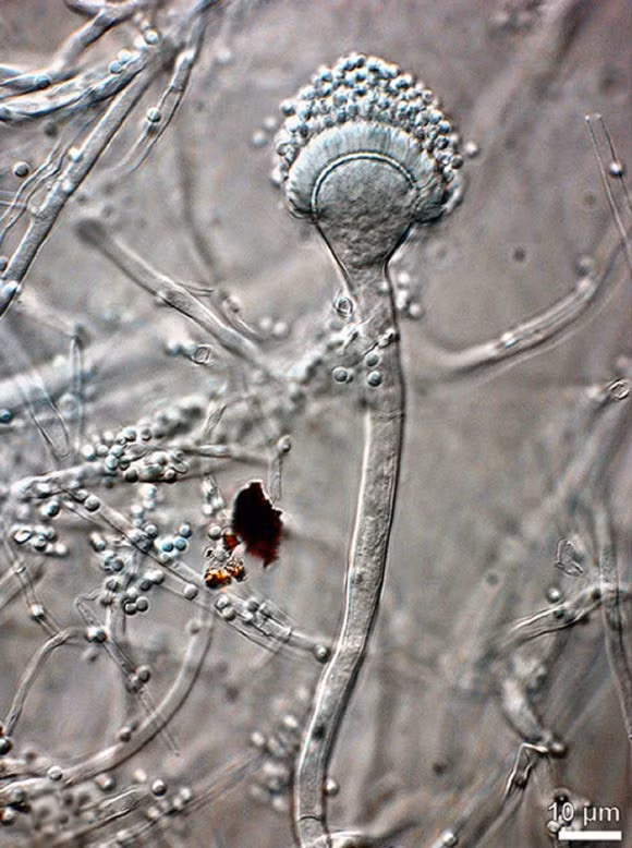 Tuy nhiên, bào tử nấm có thể phát triển sâu trong cơ thể, gây bệnh Aspergillosis lên những cá nhân đang mắc các bệnh lý về đường hô hấp như bệnh phổi tiềm ẩn, hen suyễn, những người bị suy yếu hệ miễn dịch do đang điều trị ung thư, ghép tạng, hay mắc HIV/AIDS... Theo các chuyên gia, bệnh nhiễm nấm Aspergillus có tỉ lệ tử vong rất cao (20 - 40%) và thường khó chẩn đoán được. Ảnh: Aspergillus felis (Barrs VR et al).