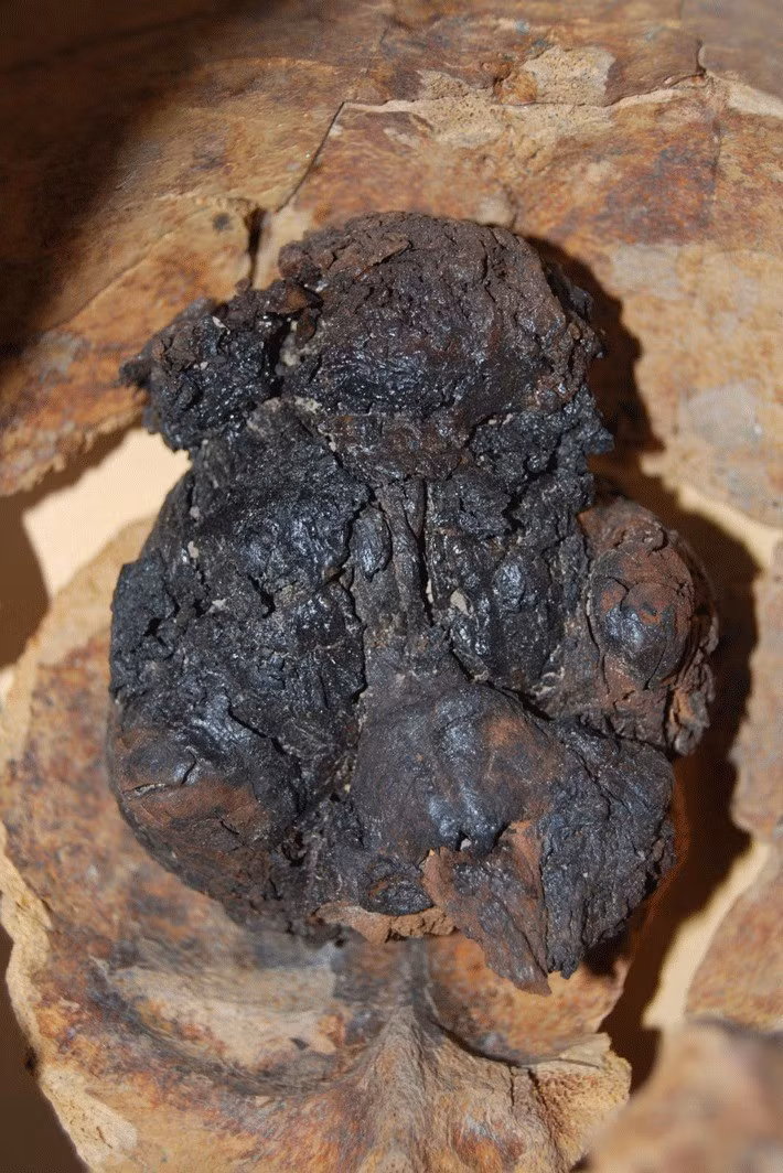 Việc nghiên cứu bộ não nguyên vẹn theo thời gian giúp các chuyên gia giải mã được nhiều thông tin về tình trạng sức khỏe, thời gian và nguyên nhân tử vong... Ảnh: Haliç University Istanbul.