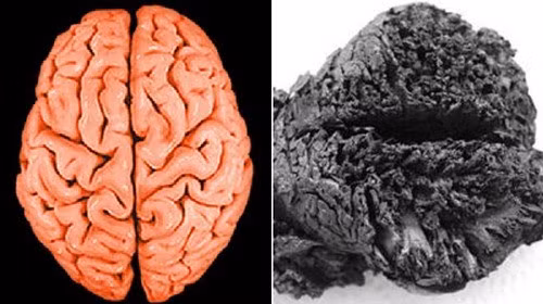 Ngọn lửa đã hút hết khí oxi và làm bốc hơi nước có trong bộ não. Việc hút cạn khí oxi và độ ẩm đã giúp bộ não được bảo tồn nguyên vẹn suốt hàng ngàn năm. Ảnh: LiveScience.