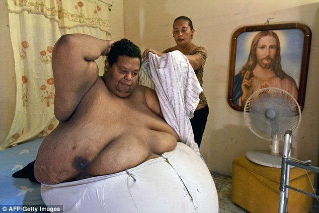 Oscar Vasquez Morales (44 tuổi) là người béo nhất Colombia với cân nặng lên tới 400kg. Các bác sĩ cảnh báo, ông có thể bị tử vong nếu không nỗ lực giảm cân.