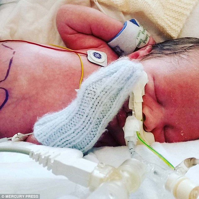 Hội chứng gastroschisis là một dị tật bẩm sinh hiếm gặp. Trường hợp của Frankie được phát hiện ở tuần thai thứ 12.