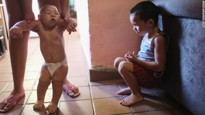 Trong khi đó, Bộ Y tế Brazil cho biết virus Zika gây ra dị tật đầu nhỏ ở bào thai. Những bà mẹ mắc virus này sẽ sinh ra con với não bộ nhỏ hơn bình thường. Hiện đã có gần 4000 trường hợp mắc virus này ở Brazil.