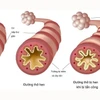 Phòng ngừa, kiểm soát hen suyễn để bảo vệ sức khỏe hô hấp