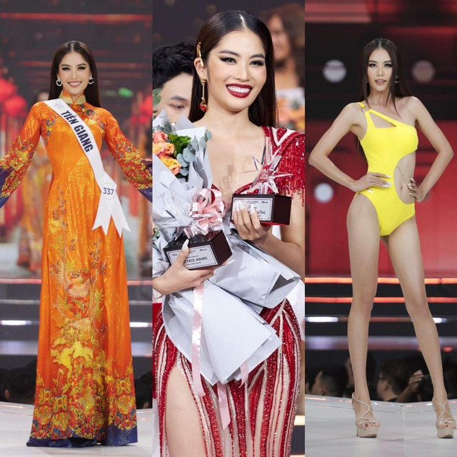 Lệ Nam nhập viện cấp cứu giữa đêm, sức khỏe giờ thế nào? - Hình 3 Le Nam nhap vien cap cuu giua dem, suc khoe gio the nao?-Hinh-3
