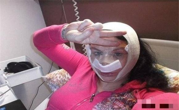 Chuyên gia tiêm vi khuẩn từ 3,5 triệu năm trước - Hình 3 Chuyen gia tiem vi khuan tu 3,5 trieu nam truoc-Hinh-3