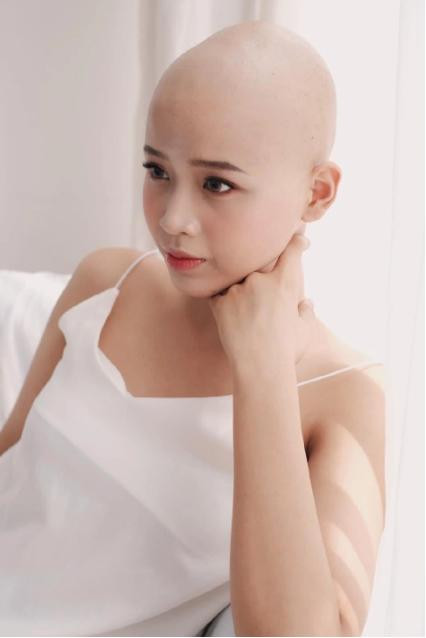 Cô gái từng chiến thắng bệnh ung thư đăng ký thi hoa hậu - Hình 2 Co gai tung chien thang benh ung thu dang ky thi hoa hau-Hinh-2