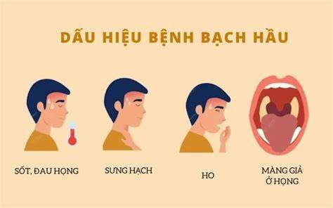 Phân biệt bệnh bạch hầu họng với các chứng viêm họng, amidan - Hình 2 Phan biet benh bach hau hong voi cac chung viem hong, amidan-Hinh-2
