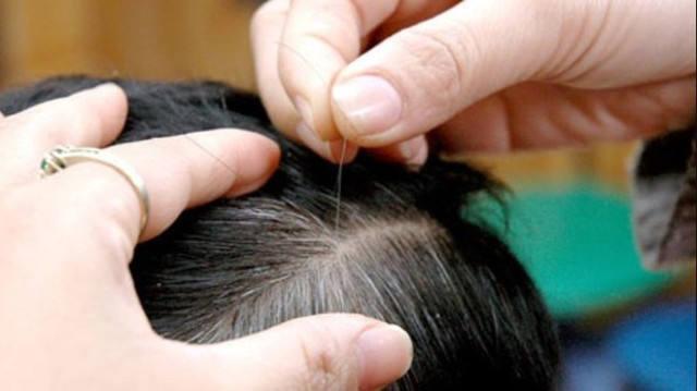 Trẻ em tóc bạc sớm có phải dấu hiệu của bệnh lý? Tre em toc bac som co phai dau hieu cua benh ly?