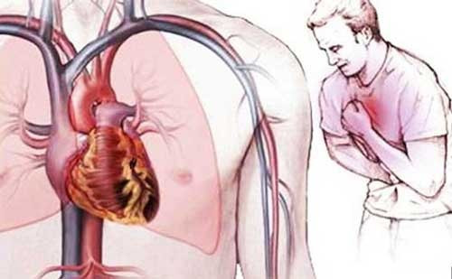 Chuyên gia mách cách bảo vệ sức khỏe tim mạch Chuyen gia mach cach bao ve suc khoe tim mach