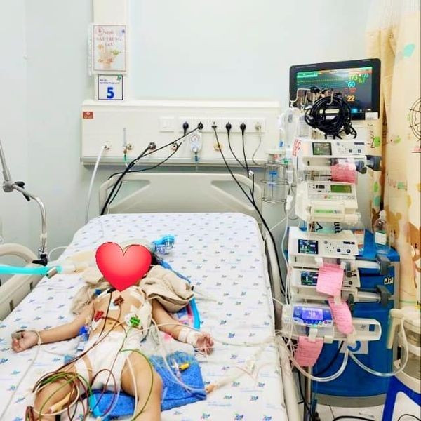 Bé 14 tháng tuổi bị biến chứng phổi do hóc hạt mãng cầu Be 14 thang tuoi bi bien chung phoi do hoc hat mang cau