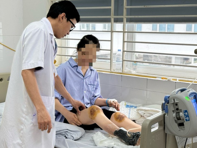 Chân hoại tử vì cho ong đốt chữa viêm khớp - Hình 4 Chan hoai tu vi cho ong dot chua viem khop-Hinh-4