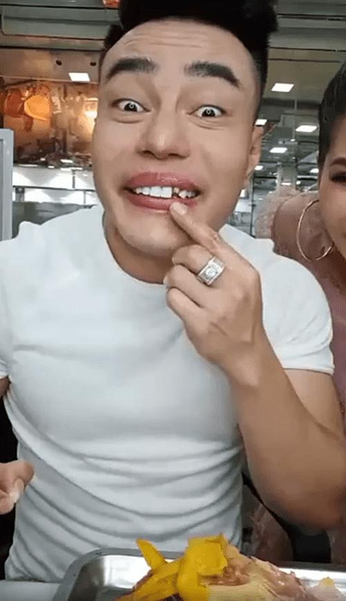 Lê Dương Bảo Lâm rụng răng sứ vì chơi gameshow quá máu - Hình 2 Le Duong Bao Lam rung rang su vi choi gameshow qua mau-Hinh-2