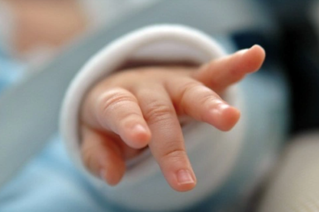 Bé gái chào đời với hội chứng siêu nữ hiếm gặp Be gai chao doi voi hoi chung sieu nu hiem gap