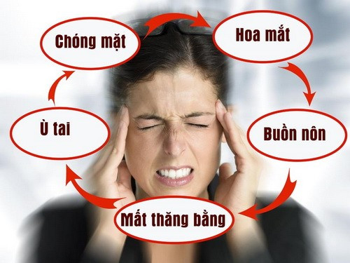 Bác sĩ chỉ cách điều trị rối loạn tiền đình Bac si chi cach dieu tri roi loan tien dinh