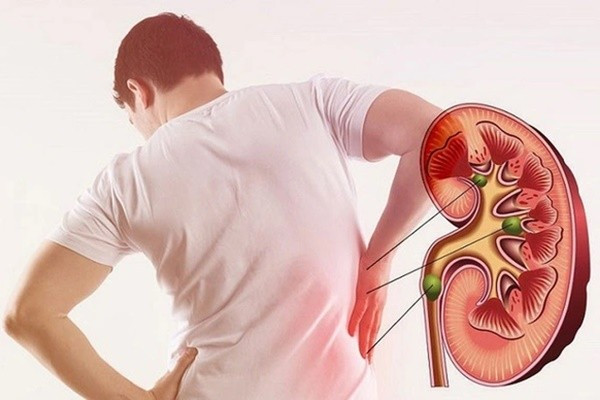 6 hành vi âm thầm “hủy hoại” thận của nam giới 6 hanh vi am tham “huy hoai” than cua nam gioi