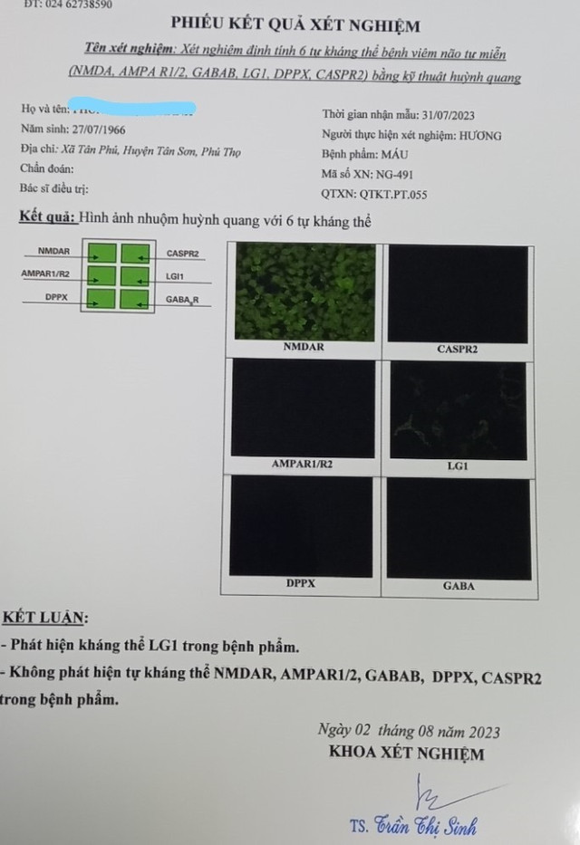 Tưởng đột quỵ, không ngờ viêm não tự miễn thể hiếm gặp - Hình 3 Tuong dot quy, khong ngo viem nao tu mien the hiem gap-Hinh-3