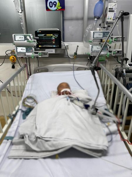 Bé 10 tháng tuổi bị Amip “ăn não”, tình trạng nguy kịch - Hình 2 Be 10 thang tuoi bi Amip “an nao”, tinh trang nguy kich-Hinh-2