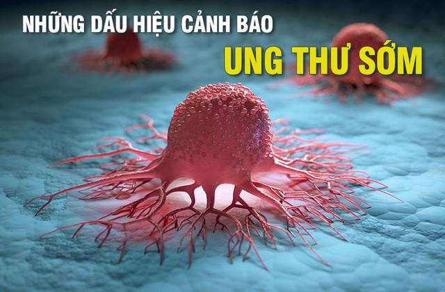 Dấu hiệu cảnh báo ung thư sớm, chớ nên chủ quan Dau hieu canh bao ung thu som, cho nen chu quan