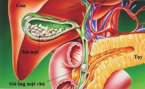 Cắt túi mật có ảnh hưởng đến sức khỏe? Cat tui mat co anh huong den suc khoe?