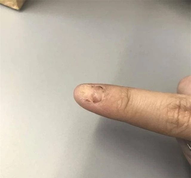 Vì sao phi hành gia từng phải rút hết móng tay trước khi bay? - Hình 2 Vi sao phi hanh gia tung phai rut het mong tay truoc khi bay?-Hinh-2