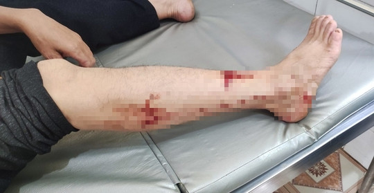 Bắc Kạn: Voọc đen má trắng quý hiếm bất ngờ tấn công người Bac Kan: Vooc den ma trang quy hiem bat ngo tan cong nguoi