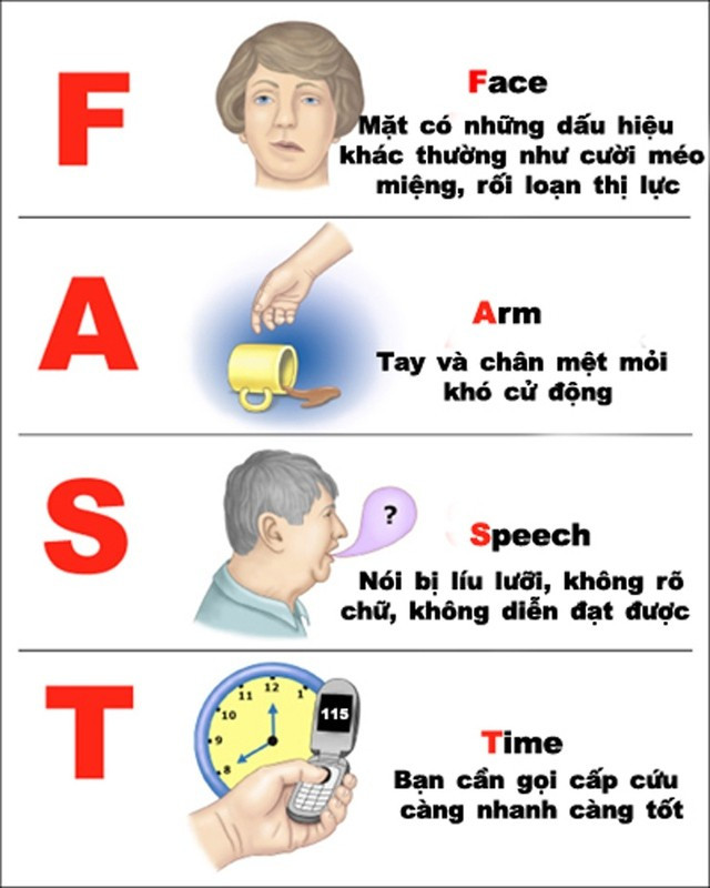 Bác sĩ khuyên 6 điều nên làm, 3 điều tránh với bệnh nhân đột quỵ - Hình 2 Bac si khuyen 6 dieu nen lam, 3 dieu tranh voi benh nhan dot quy-Hinh-2