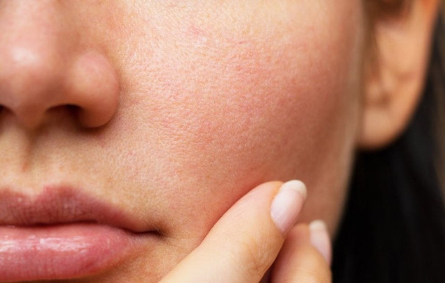 8 thói quen xấu khiến da khô chị em nên tránh 8 thoi quen xau khien da kho chi em nen tranh
