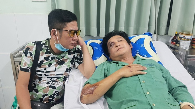 Nghệ sĩ Trọng Phúc bị tai nạn giao thông, chấn thương ở mặt Nghe si Trong Phuc bi tai nan giao thong, chan thuong o mat