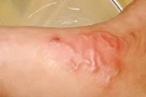 Bệnh giun sán gia tăng tại Khánh Hòa, nguy cơ từ nuôi chó mèo