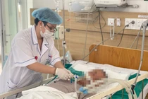 3 người ở Sơn La nghi ngộ độc thực phẩm, nhận diện các biểu hiện 