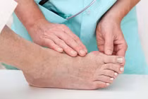 Bác sĩ cảnh báo tự ý dùng corticoid trị gout có thể gây tàn phế