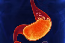 Dấu hiệu cảnh báo ung thư dạ dày cần phải khám ngay