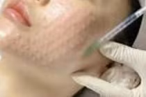 Cẩn trọng với 'bẫy' làm đẹp siêu tốc cận Tết