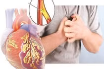 Dấu hiệu âm thầm cảnh báo bệnh tim