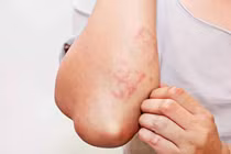 Nhiễm giun sán có thể gây ra nhiều vấn đề sức khỏe nghiêm trọng