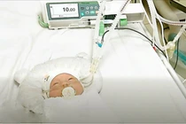 Phẫu thuật cấp cứu lấy thai suy hô hấp thành công