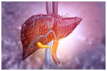 Các dấu hiệu cảnh báo chức năng gan suy yếu