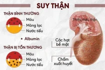 Sai lầm phổ biến khi điều trị suy thận khiến bệnh nặng hơn
