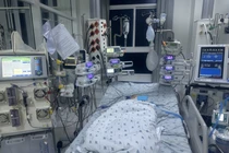 Lọc máu liên tục cứu sống bệnh nhi mắc tay chân miệng biến chứng nặng