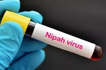 Yêu cầu khoanh vùng, xử lý triệt để nếu xuất hiện ca bệnh do virus Nipah