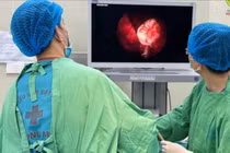 Răng mọc lạc chỗ vào xoang hàm, tình trạng hiếm gặp, có thể gây biến chứng