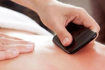 Suýt mất mạng vì nhầm các triệu chứng nhồi máu cơ tim cấp với 'trúng gió'