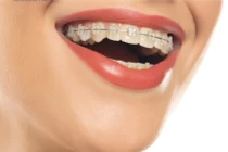 Nha khoa Thẩm mỹ Anh Dental bị phạt 80 triệu, giá dịch vụ thế nào?