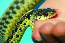 Bác sĩ cảnh báo không dùng bài thuốc dân gian chữa rắn cắn