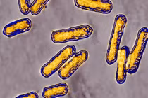 Vi khuẩn Listeria liên quan đến thực phẩm chế biến sẵn